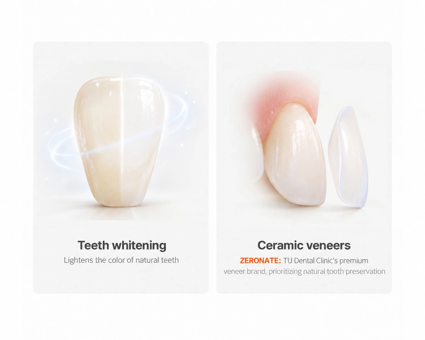 Whitening lightens natural teeth. Ceramic veneers cover the front surfaces to adjust their appearance. ZERONATE is TU Dental Clinic’s premium ceramic veneer brand, with a focus on preserving natural teeth.