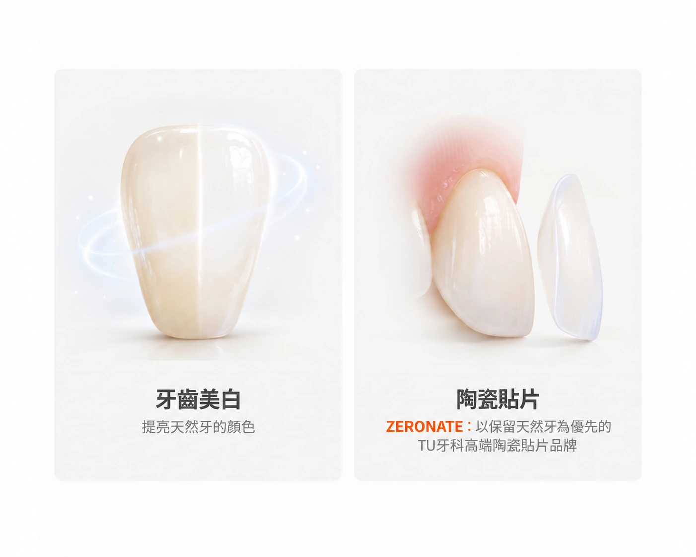牙齒美白用來提亮天然齒色；陶瓷貼片則透過覆蓋牙齒正面調整外觀。ZERONATE 是 TU牙科以保留天然牙為優先的高端陶瓷貼片品牌。