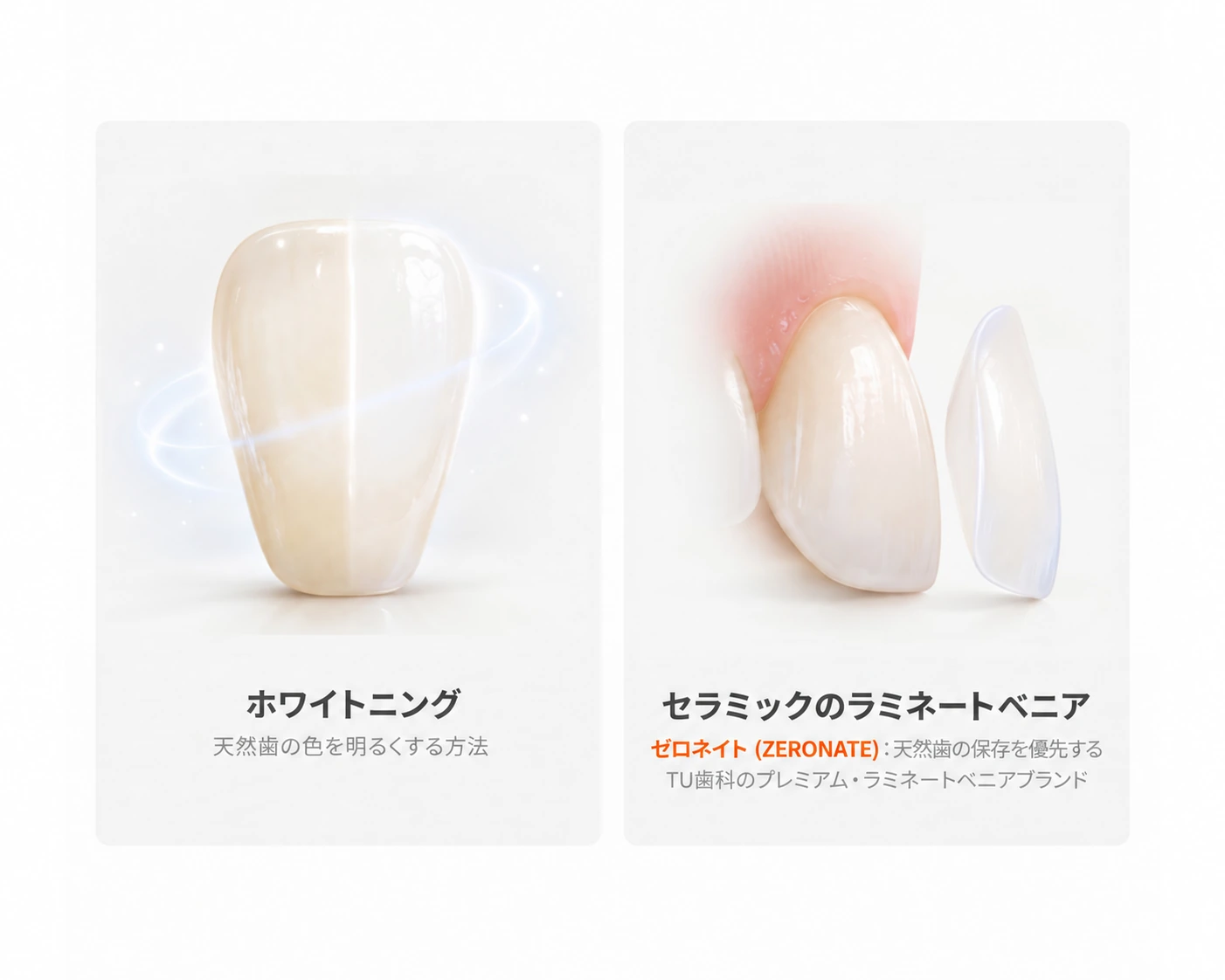 ホワイトニングは天然歯の色を明るくする方法です。セラミックのラミネートベニアは歯の表側を覆って見た目を整えます。ゼロネイトは、天然歯の保存を優先するTU歯科のプレミアム・ラミネートベニアブランドです。