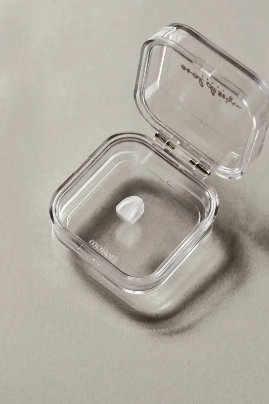 前歯のすき間（正中離開・Diastema）はゼロネイト(ZERONATE)で改善できますか？
